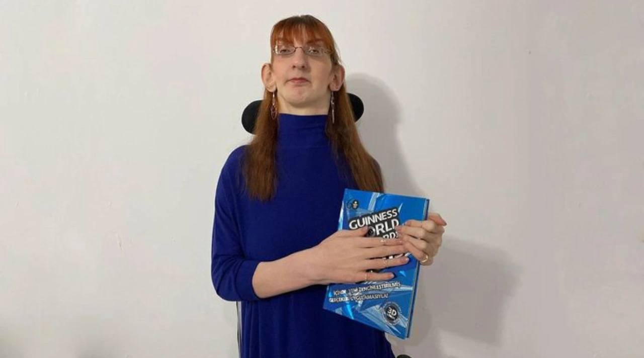 Perjalanan Hidup Rumeysa Gelgi, Perempuan Tertinggi di Dunia